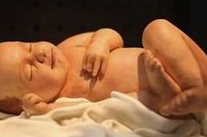 襄阳三代试管婴儿费用大约是多少？