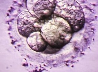 濮阳试管婴儿哪个医院比较好？